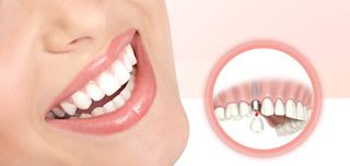 Exclusiva Odontologia - Implantes Dentrios e Prteses no Belvedere